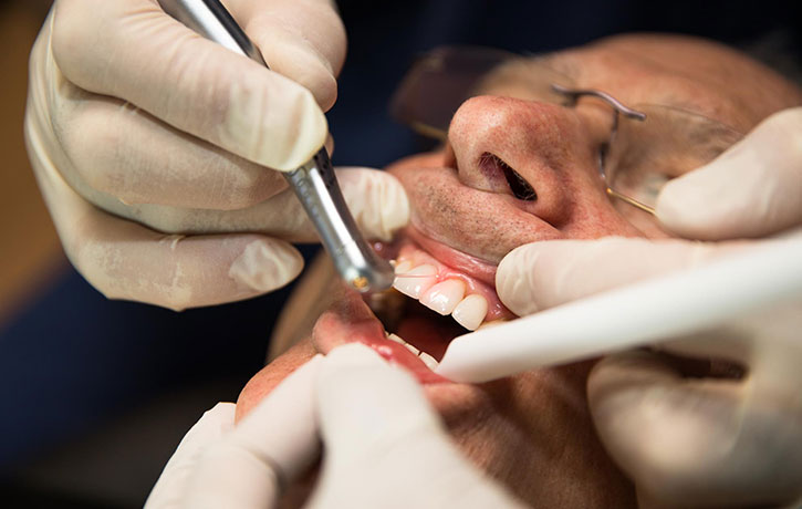 Laser Gum Therapy Las Vegas, NV